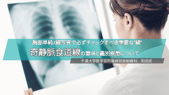 胸部単純X線写真の重要な”線”　「奇静脈食道線」の意味と鑑別疾患について
