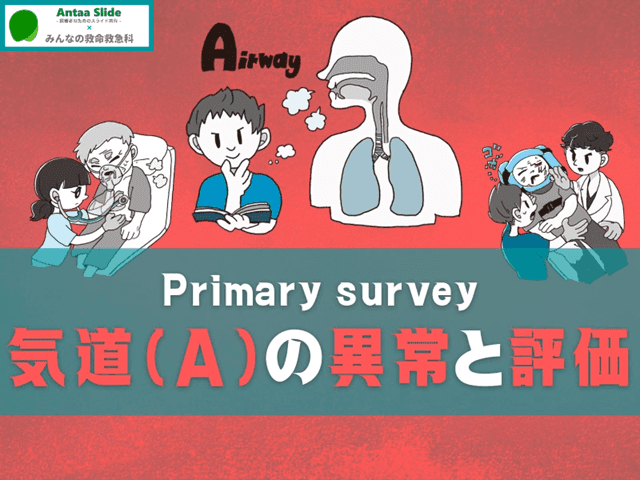 Primary survey 気道(A)の異常【解剖・気道確保を中心に】
