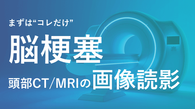 【デキレジ】脳梗塞③頭部CT/MRIの画像読影