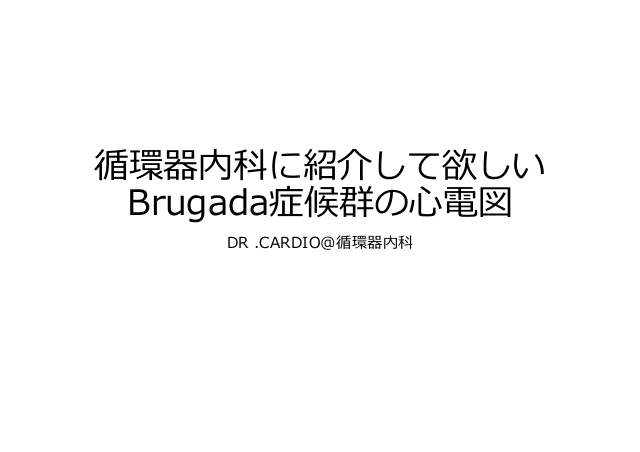 循環器内科に紹介して欲しいBrugada症候群の心電図