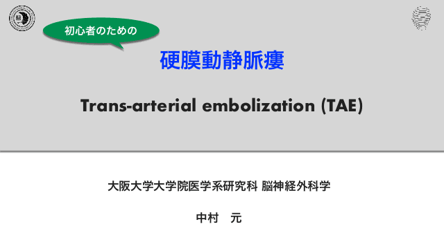 初心者のための硬膜動静脈瘻（dAVF）経動脈塞栓術（TAE）入門｜Borden分類と塞栓物質の選び方｜中村元先生