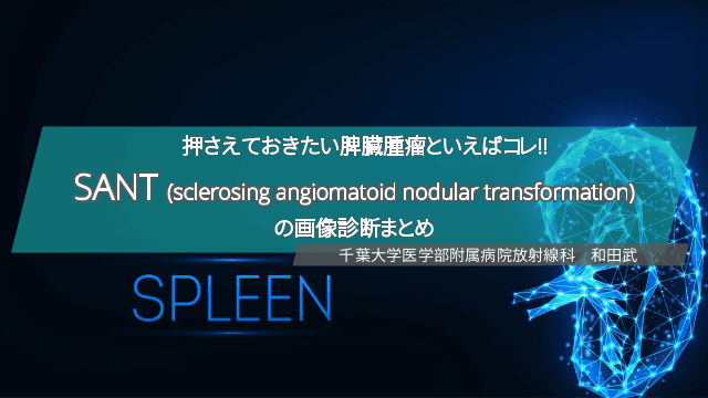 押さえておきたい脾臓腫瘤といえばコレ!!　SANT (sclerosing angiomatoid nodular transformation) の画像診断まとめ