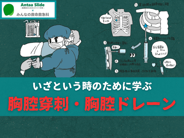 【いざという時のために学ぶ】胸腔穿刺・胸腔ドレーンのまとめ