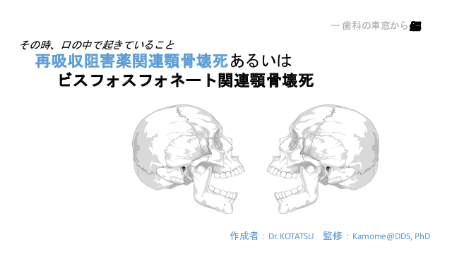 再吸収阻害薬関連顎骨壊死あるいはビスフォスフォネート関連顎骨壊死 ー 歯科の車窓から🚂