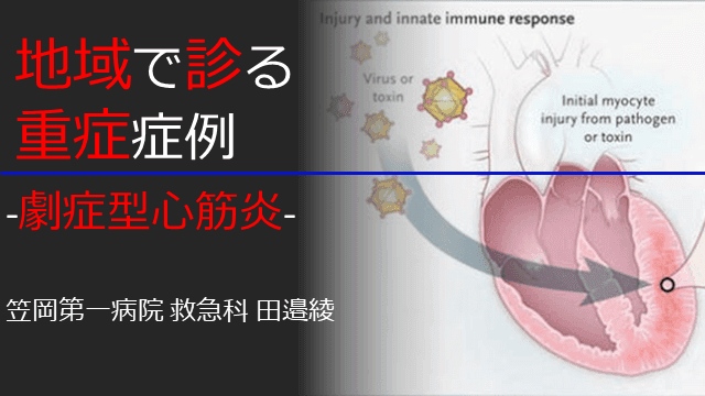 地域で診る重症症例 -劇症型心筋炎-