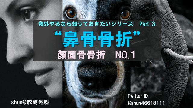 “鼻骨骨折” 顔面骨骨折NO.１ 救外やるなら知っておきたいシリーズ　Part３