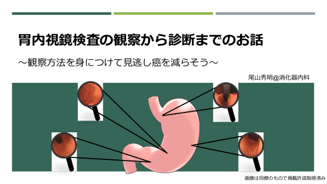 胃内視鏡検査の観察から診断までのお話〜観察方法を身につけて見逃し癌を減らそう〜