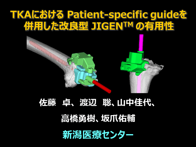 TKAにおける Patient-specific guideを併用した改良型 JIGEN の有用性
