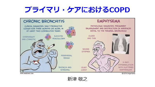 プライマリ・ケアにおけるCOPD