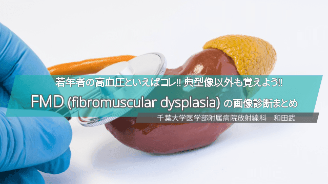 若年者の高血圧といえばコレ!! 典型像以外も覚えよう!!FMD (fibromuscular dysplasia) の画像診断まとめ