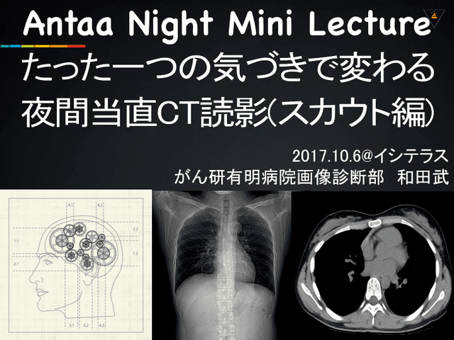 夜間当直CT読影の仕方！スカウトで迫る画像診断