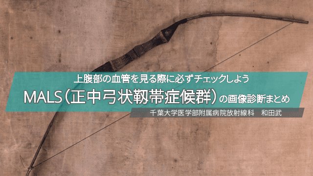 上腹部の血管を見る際に必ずチェックしようMALS（正中弓状靱帯症候群）の画像診断まとめ