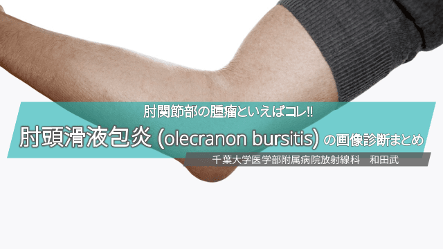 肘関節部の腫瘤といえばコレ!! 肘頭滑液包炎 (olecranon bursitis) の画像診断まとめ