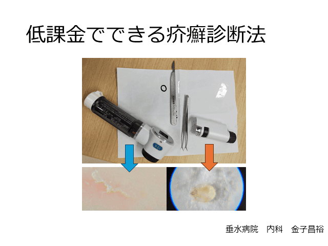 低課金でできる疥癬診断法