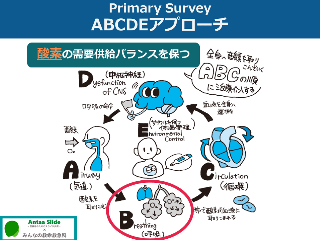Primary survey 呼吸(B)の異常【メカニズムの評価を中心に】 | Antaa Slide