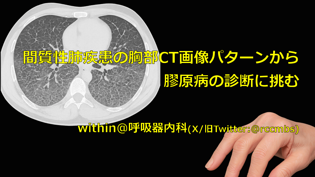 間質性肺疾患の胸部CT画像パターンから  膠原病の診断に挑む L1.png