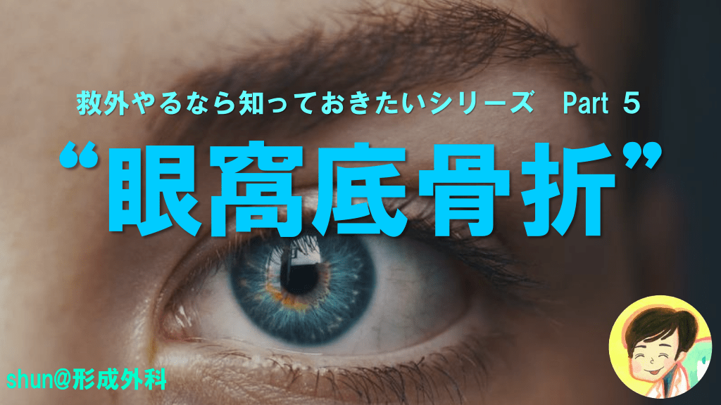 眼窩底骨折 救外やるなら知っておきたいシリーズpart 5 Antaa Slide 眼窩底骨折 救外やるなら知っておきたいシリーズpart 5 Antaa Slide