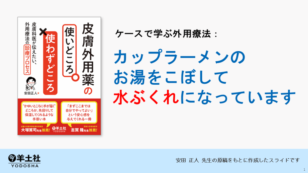 ケースで学ぶ外用療法：カップラーメンのお湯をこぼして水ぶくれになっています L001.png