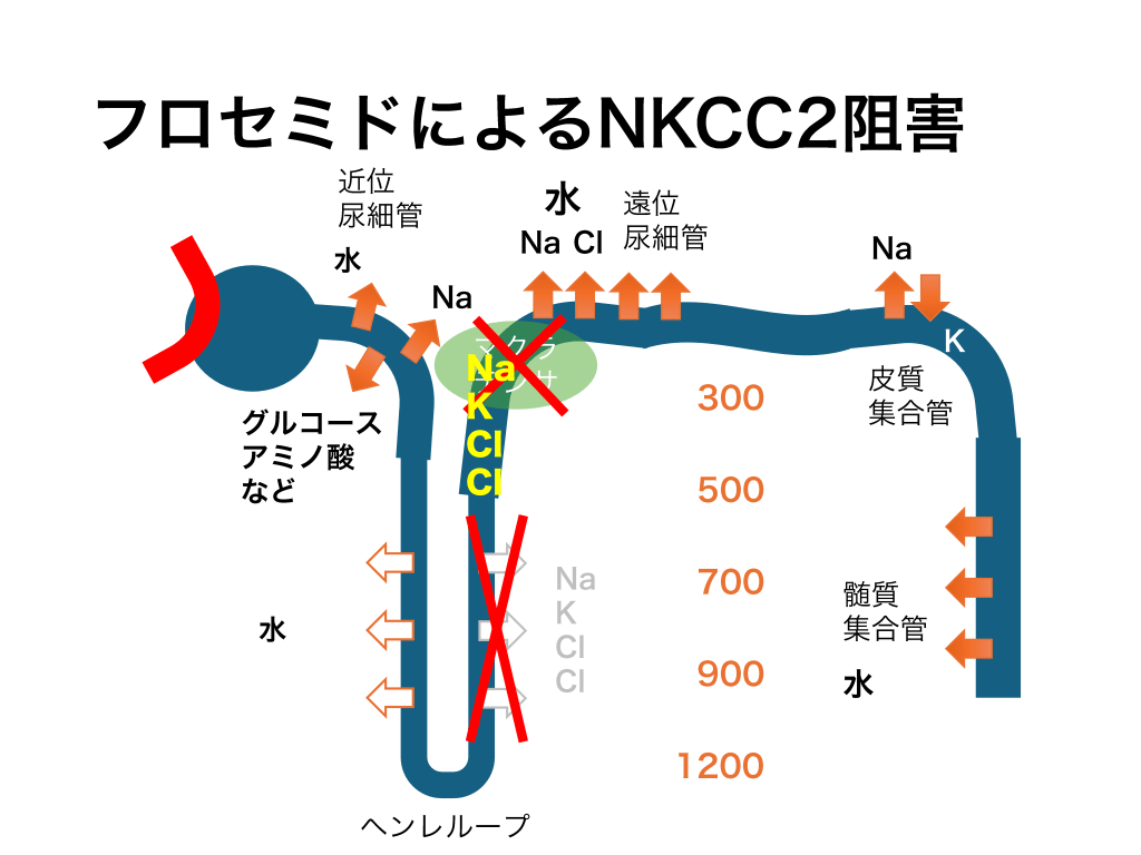 利尿薬抵抗性(クロールの逆襲) | Antaa Slide
