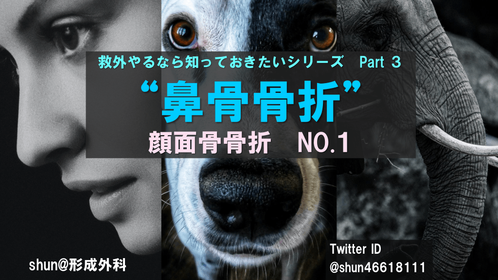 鼻骨骨折 顔面骨骨折no 1 救外やるなら知っておきたいシリーズ Part3 Antaa Slide 鼻骨骨折 顔面骨骨折no 1 救外やるなら知っておきたいシリーズ Part3 Antaa Slide