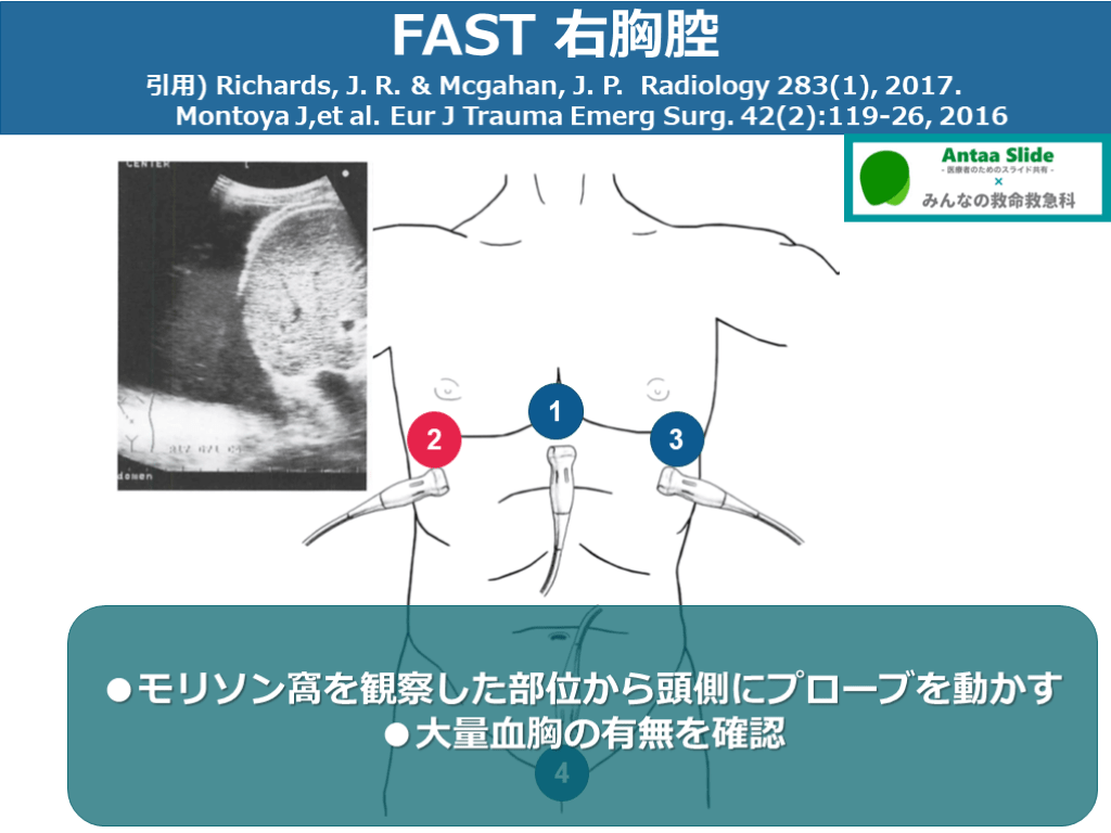 形成外科】外傷形成外科 そのときあなたは対応できるか