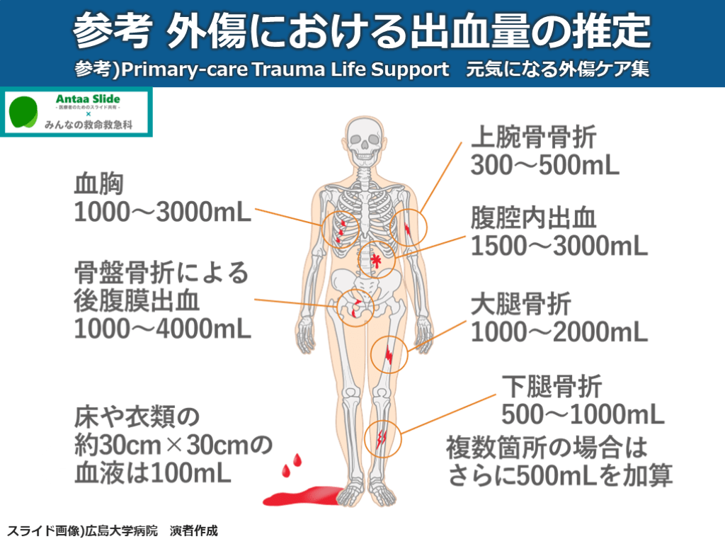 外傷初期診療のまとめ | Antaa Slide