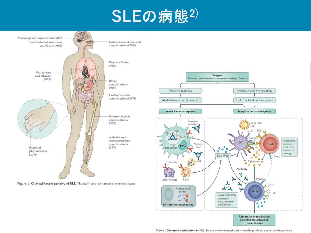 Sle Project Sle 活動期 _ Sle 観察項目 | KAKEN — 研究課題をさがす – AWYAK