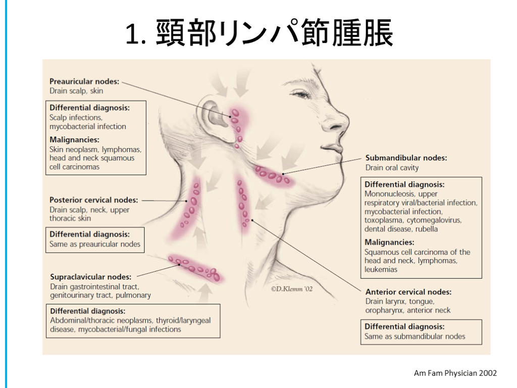 リンパ節の腫脹: リンパ節腫脹の原因 – TJTO