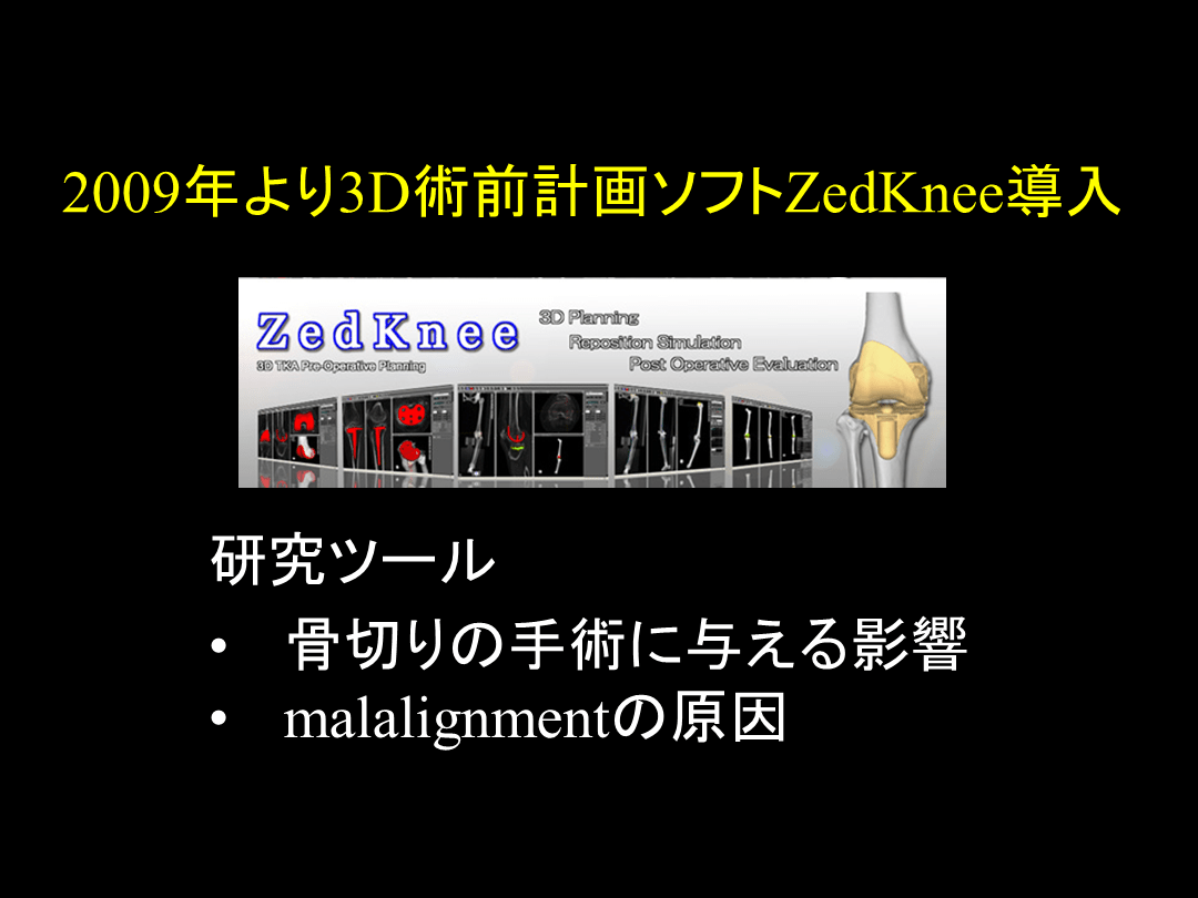 3D 術前計画ソフトを用いたTKAの実際 | Antaa Slide