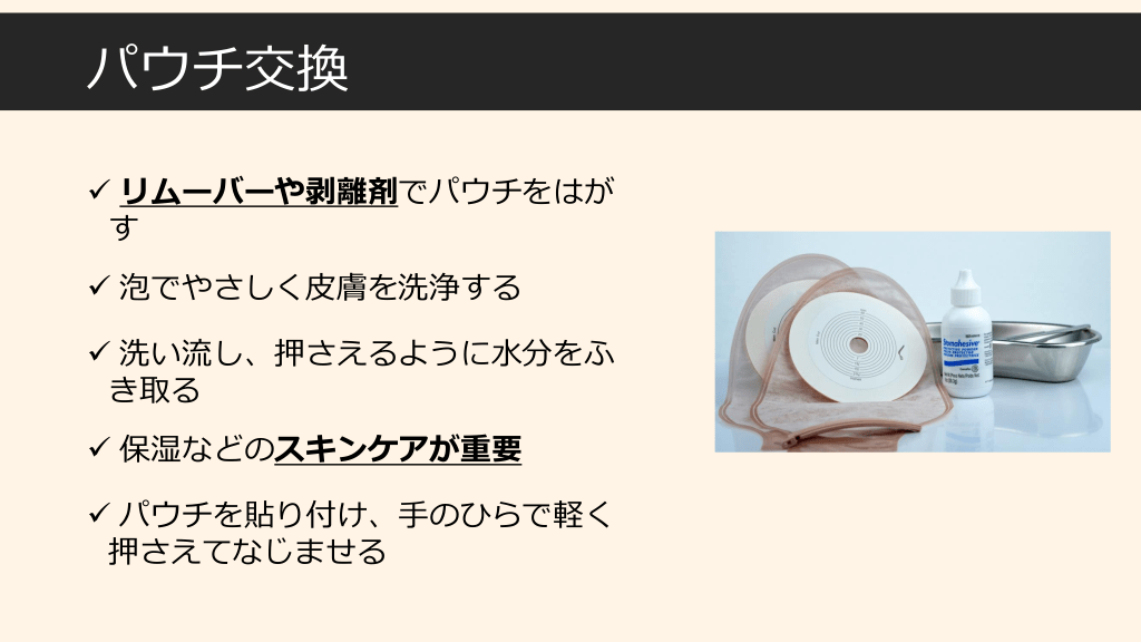 人工肛門の種類とケアの仕方を学ぼう | Antaa Slide