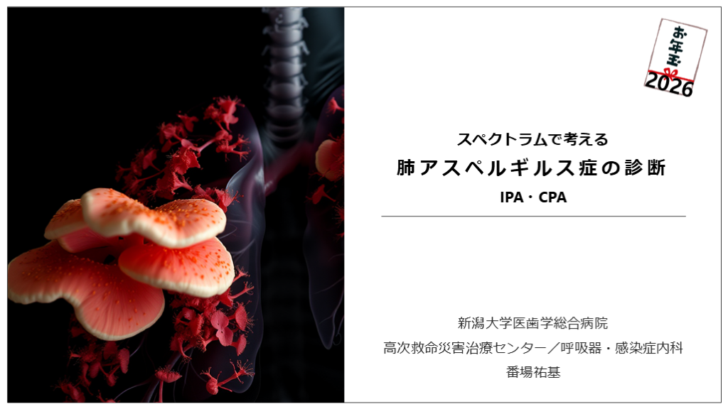 肺アスペルギルス症　IPA・CPA【診断編】 L001.png