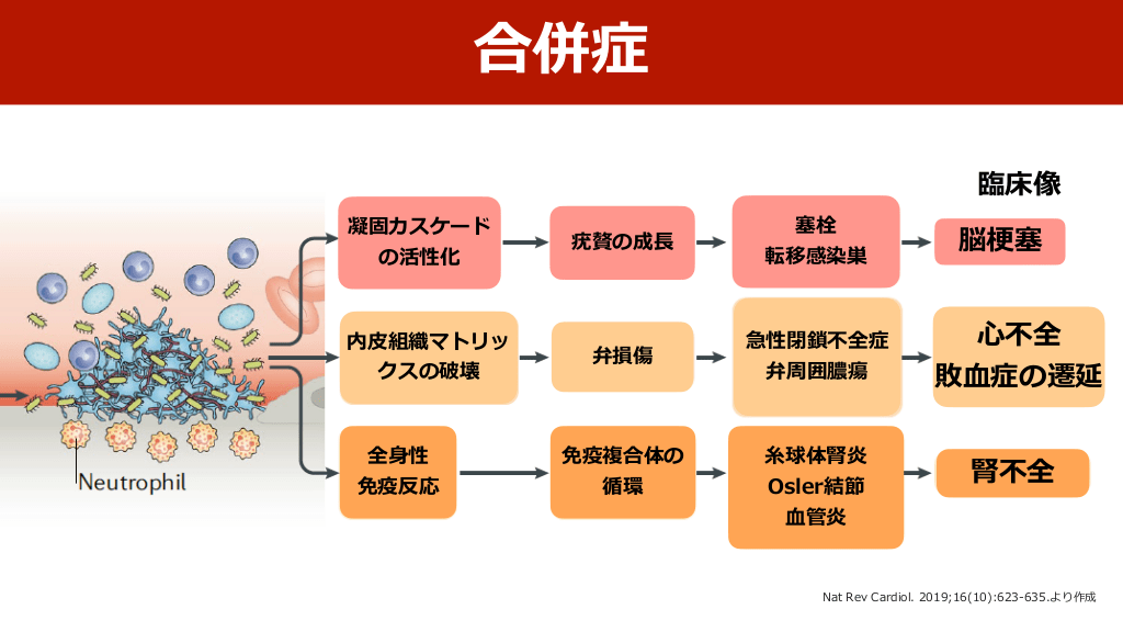 最新のPrimer:感染性心内膜炎 | 感染性心内膜炎の症状と治療薬の完全ガイド – MIWOOV