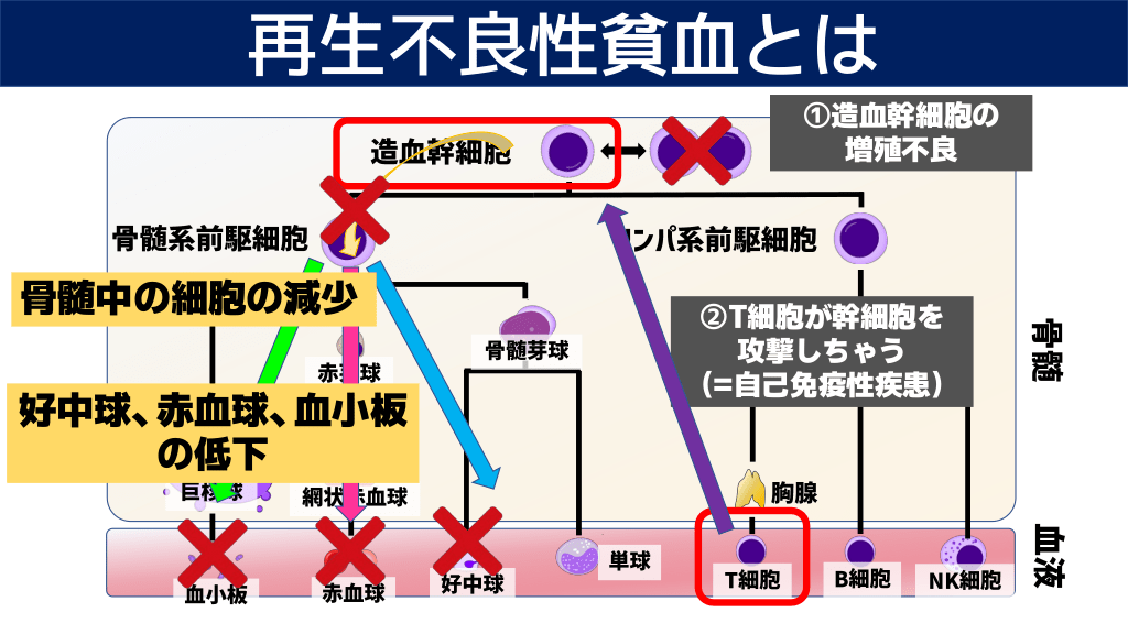 再生不良性貧血の病態を理解すると、治療法も自然に理解できます!!! | Antaa Slide