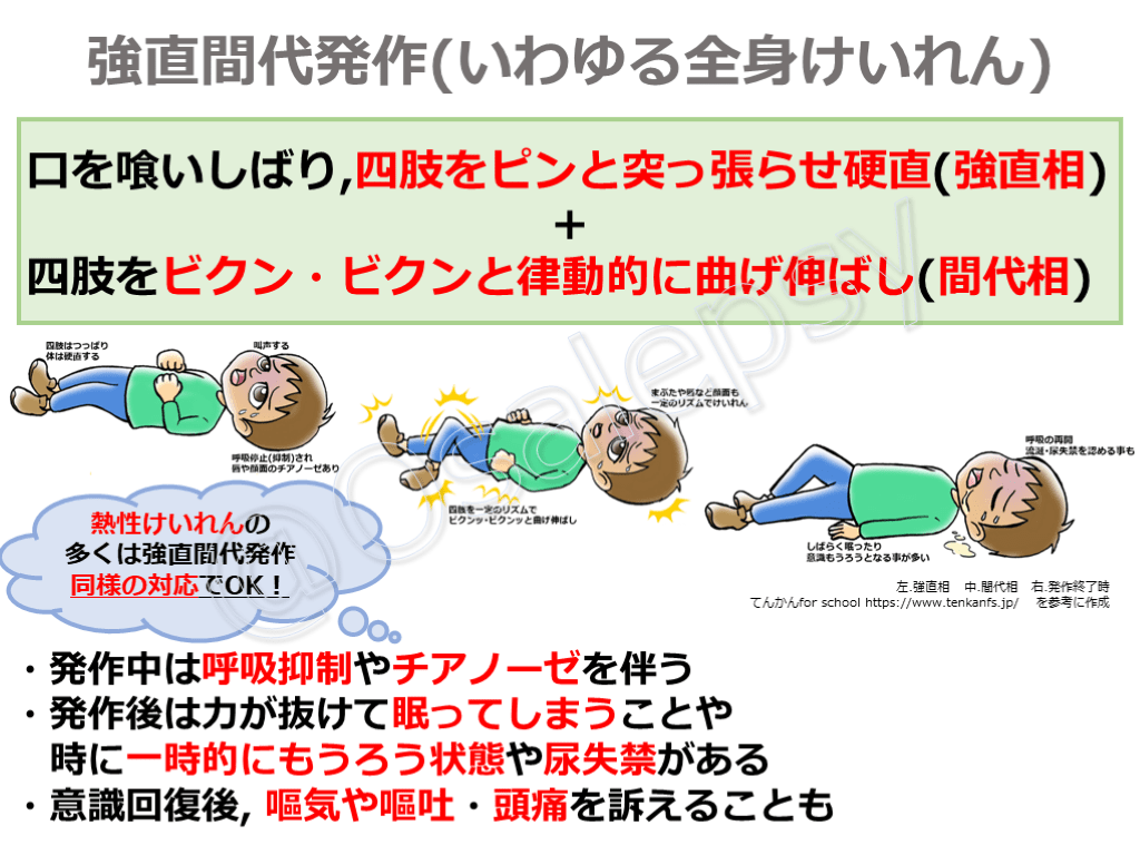 てんかん対処法間違い | てんかんの症状と対処方法 _ 犬のてんかんが正しく分かる!犬のてんかんの種類と対処法 – YGHB