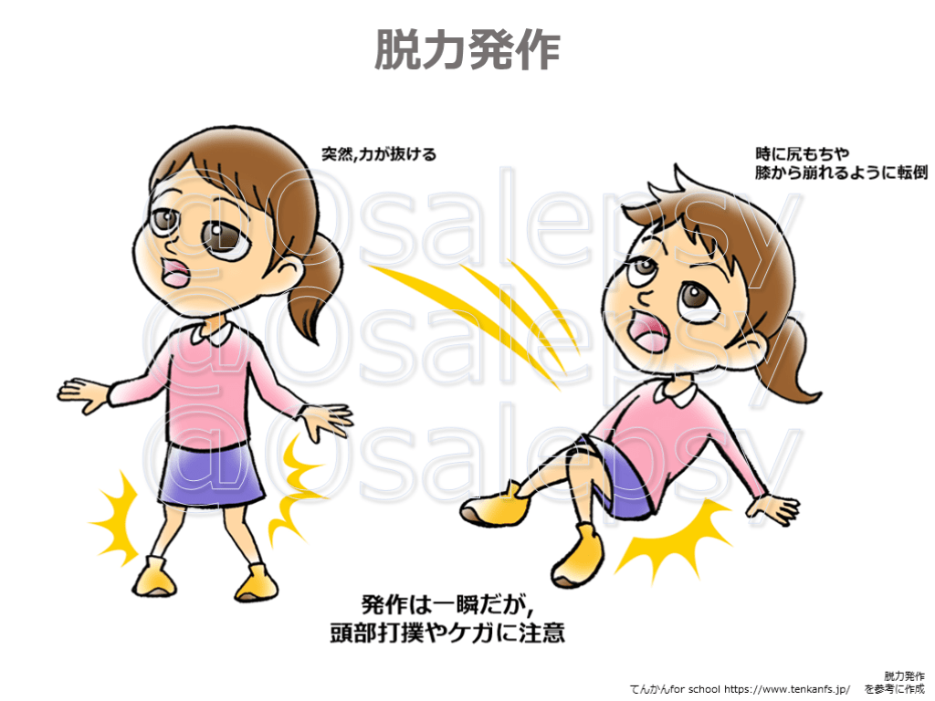 説明にそのまま使える 病院外におけるけいれん・てんかん発作に出くわした際の対処法 | Antaa Slide