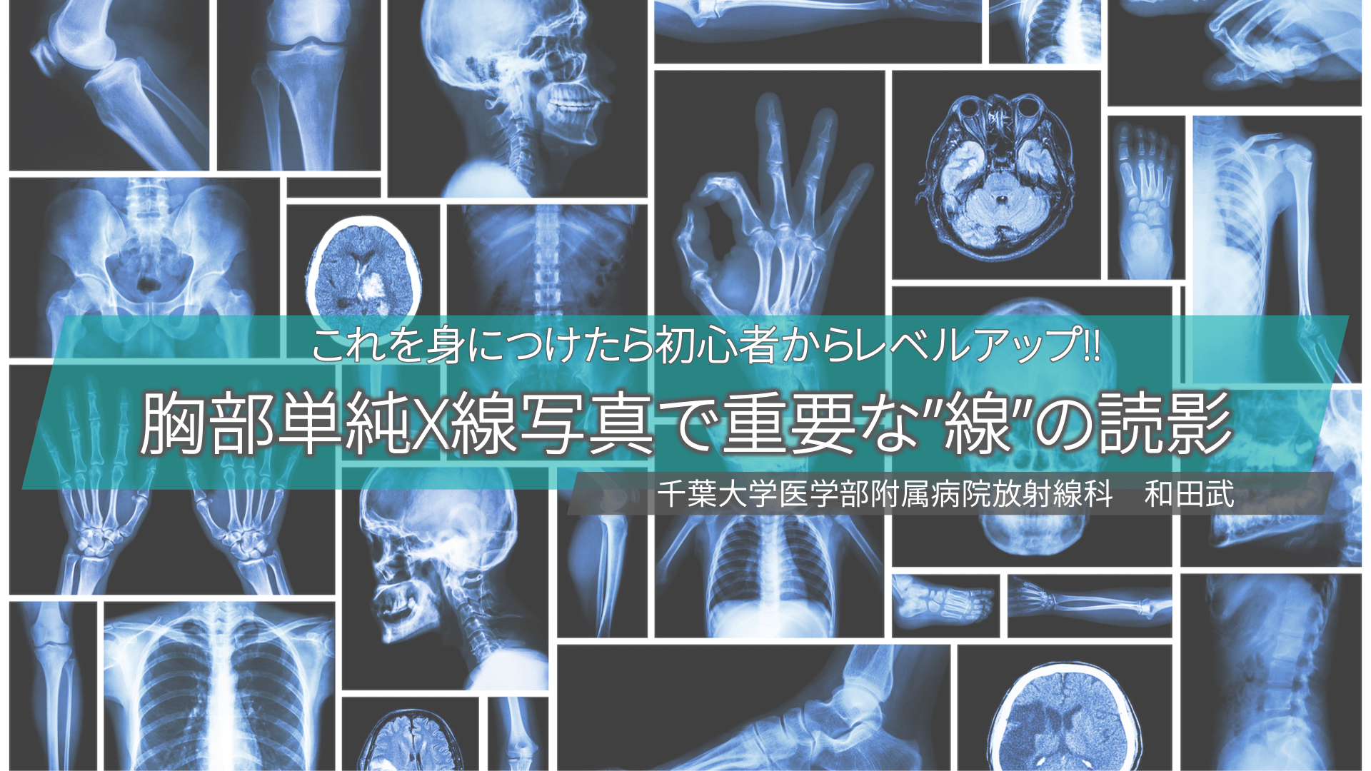 これを身につけたら初心者からレベルアップ!! 胸部単純X線写真で重要な