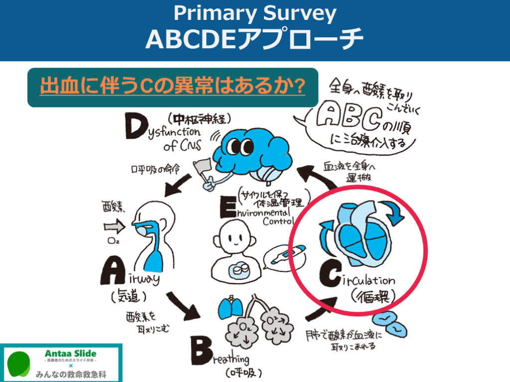 四肢不全切断の初期診療【血行評価を中心に】 | Antaa Slide