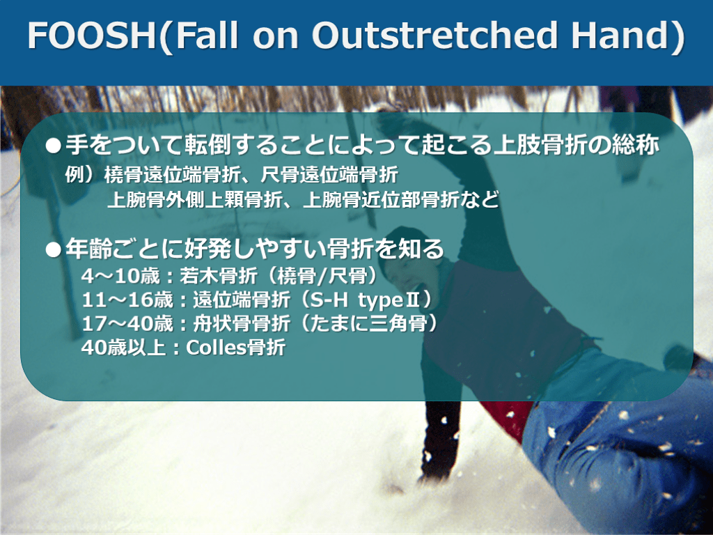 【症例で学ぶ!】+αの外傷診療【手をついた FOOSH injury】 | Antaa Slide