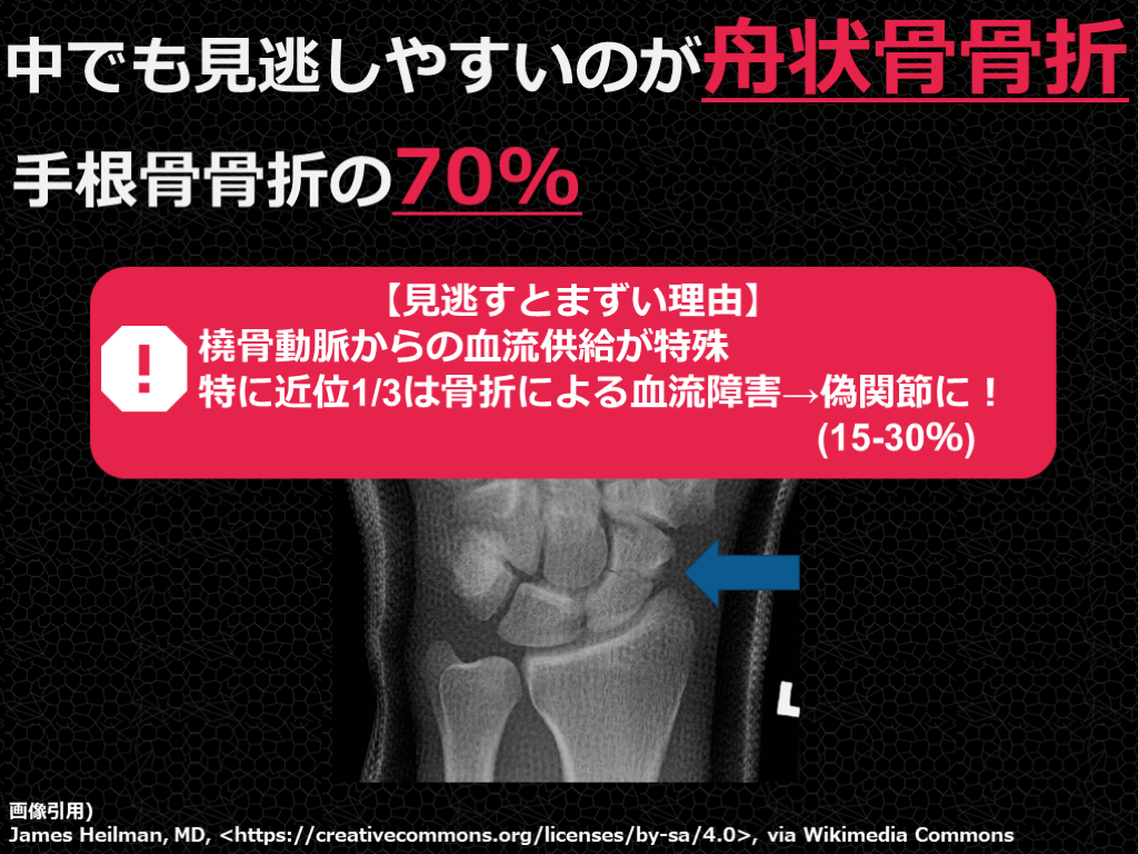 【症例で学ぶ!】+αの外傷診療【手をついた FOOSH injury】 | Antaa Slide