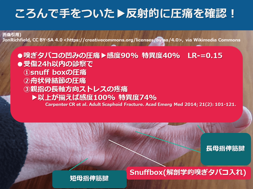 【症例で学ぶ!】+αの外傷診療【手をついた FOOSH injury】 | Antaa Slide