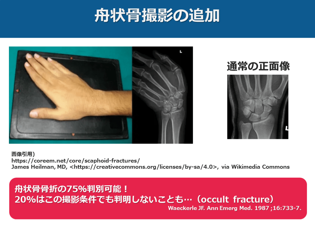 【症例で学ぶ!】+αの外傷診療【手をついた FOOSH injury】 | Antaa Slide