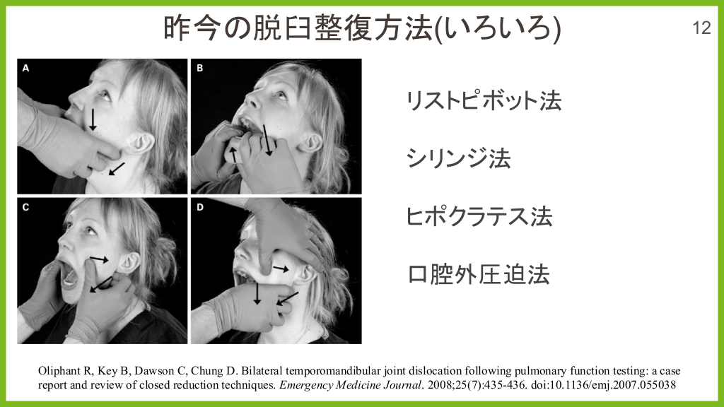5分でわかる 10秒で治せる あご 脱臼整復 | Antaa Slide