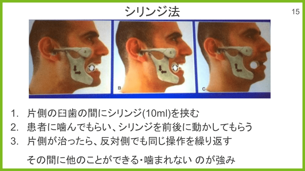 顎関節脱臼整復法動画 | 顎関節脱臼 ヒポクラテス法 – 5分でわかる 10秒で治せる あご 脱臼整復 – FJESP