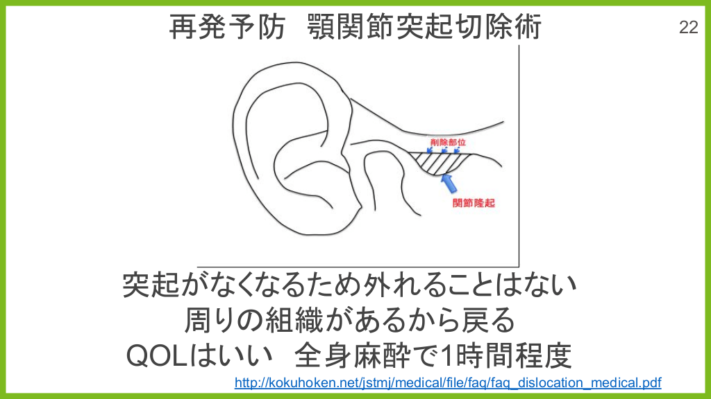 5分でわかる 10秒で治せる あご 脱臼整復 | Antaa Slide