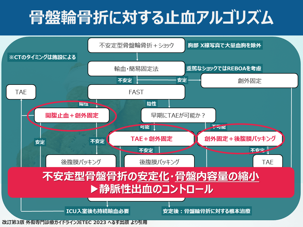 一時的創外固定マニュアル　裁断済み 一時的創外固定マニュアル | 日本四肢再建・創外固定学会 |本