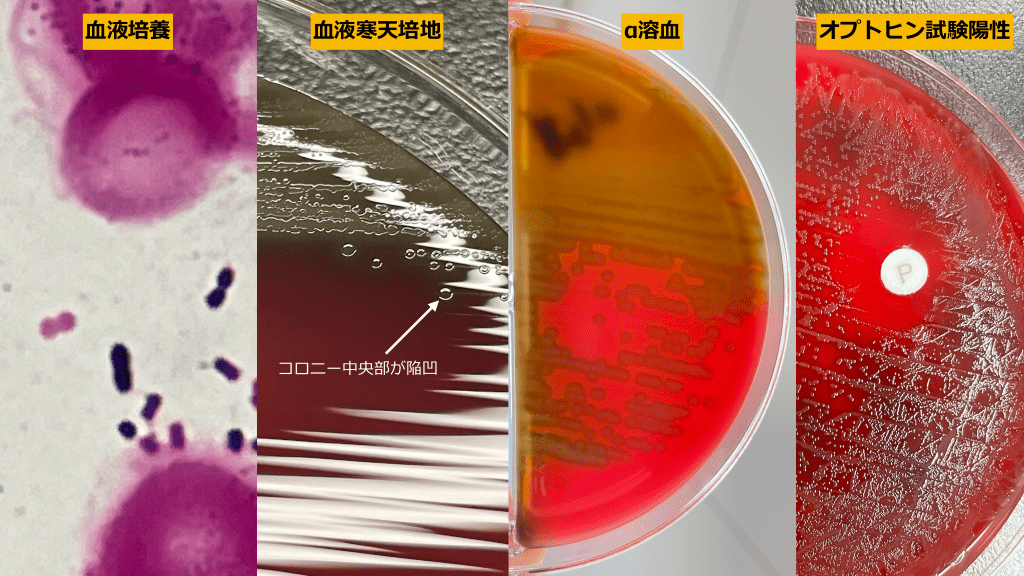 連鎖球菌よもやま Antaa Slide