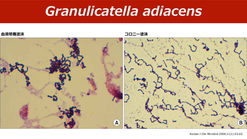 連鎖球菌よもやま Antaa Slide