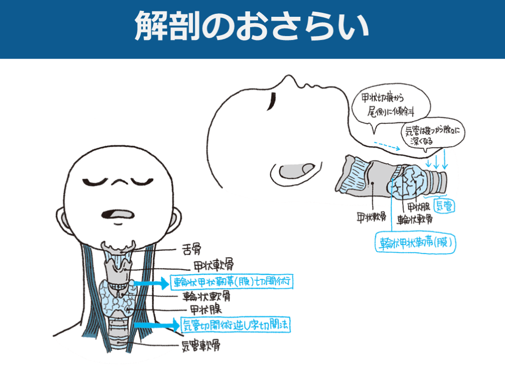 輪状甲状切開術と気管切開術の目的