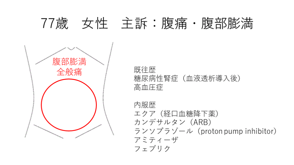 急性腹症のCT 急性腹症のCT |本 | 通販 | Amazon