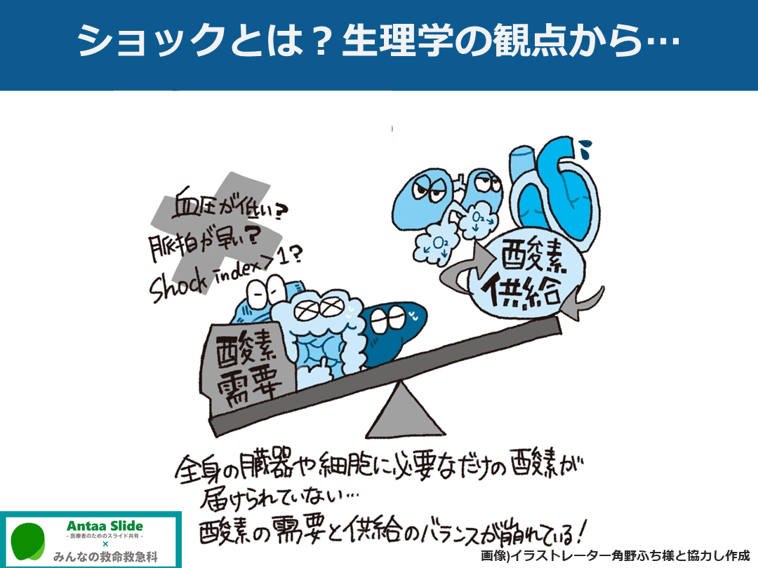 ショックのまとめ【定義・分類・鑑別を中心に】 | Antaa Slide